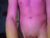 ♂️ frameteeen Free Cam @ Chaturbate